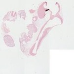 EMAGE:22886
