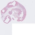 EMAGE:22922