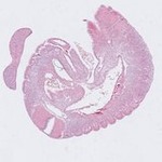EMAGE:22922