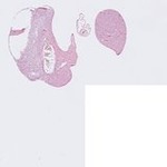 EMAGE:22922