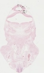 EMAGE:22942
