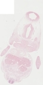 EMAGE:22942