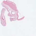 EMAGE:22962