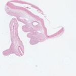 EMAGE:22962