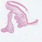 EMAGE:22962