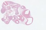 EMAGE:22962