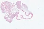 EMAGE:22962