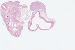EMAGE:22962