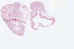 EMAGE:22962