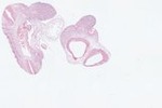 EMAGE:22962