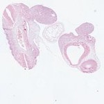 EMAGE:22962