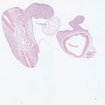 EMAGE:22962