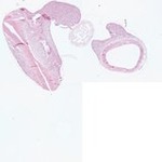 EMAGE:22962