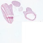 EMAGE:22962
