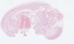 EMAGE:22963