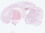 EMAGE:22963