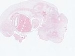 EMAGE:22963