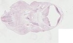EMAGE:22990