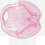 EMAGE:23037