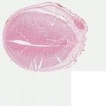 EMAGE:23039