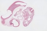 EMAGE:23071