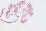EMAGE:23071