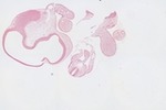 EMAGE:23071