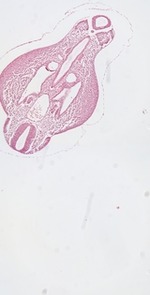EMAGE:23071