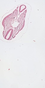 EMAGE:23071