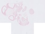 EMAGE:23135