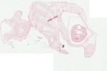 EMAGE:23219