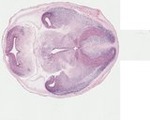 EMAGE:23330