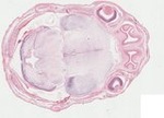 EMAGE:23333
