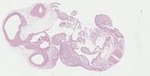 EMAGE:23335