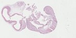 EMAGE:23335