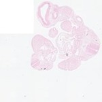 EMAGE:23412