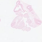 EMAGE:23412