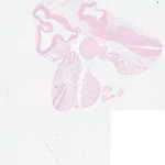 EMAGE:23412