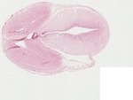 EMAGE:23508