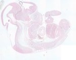 EMAGE:23603
