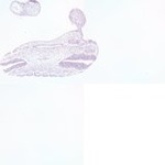 EMAGE:23604