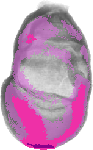 mouse atlas EMAGE spatial in situ gene expression database None
