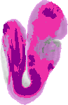 mouse atlas EMAGE spatial in situ gene expression database None