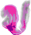 mouse atlas EMAGE spatial in situ gene expression database None