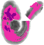 mouse atlas EMAGE spatial in situ gene expression database None