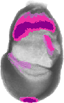 mouse atlas EMAGE spatial in situ gene expression database None