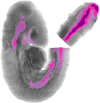 mouse atlas EMAGE spatial in situ gene expression database None