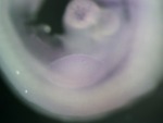 EMAGE:24685