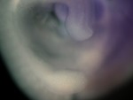 EMAGE:24799
