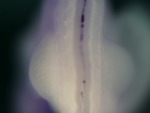 EMAGE:24807